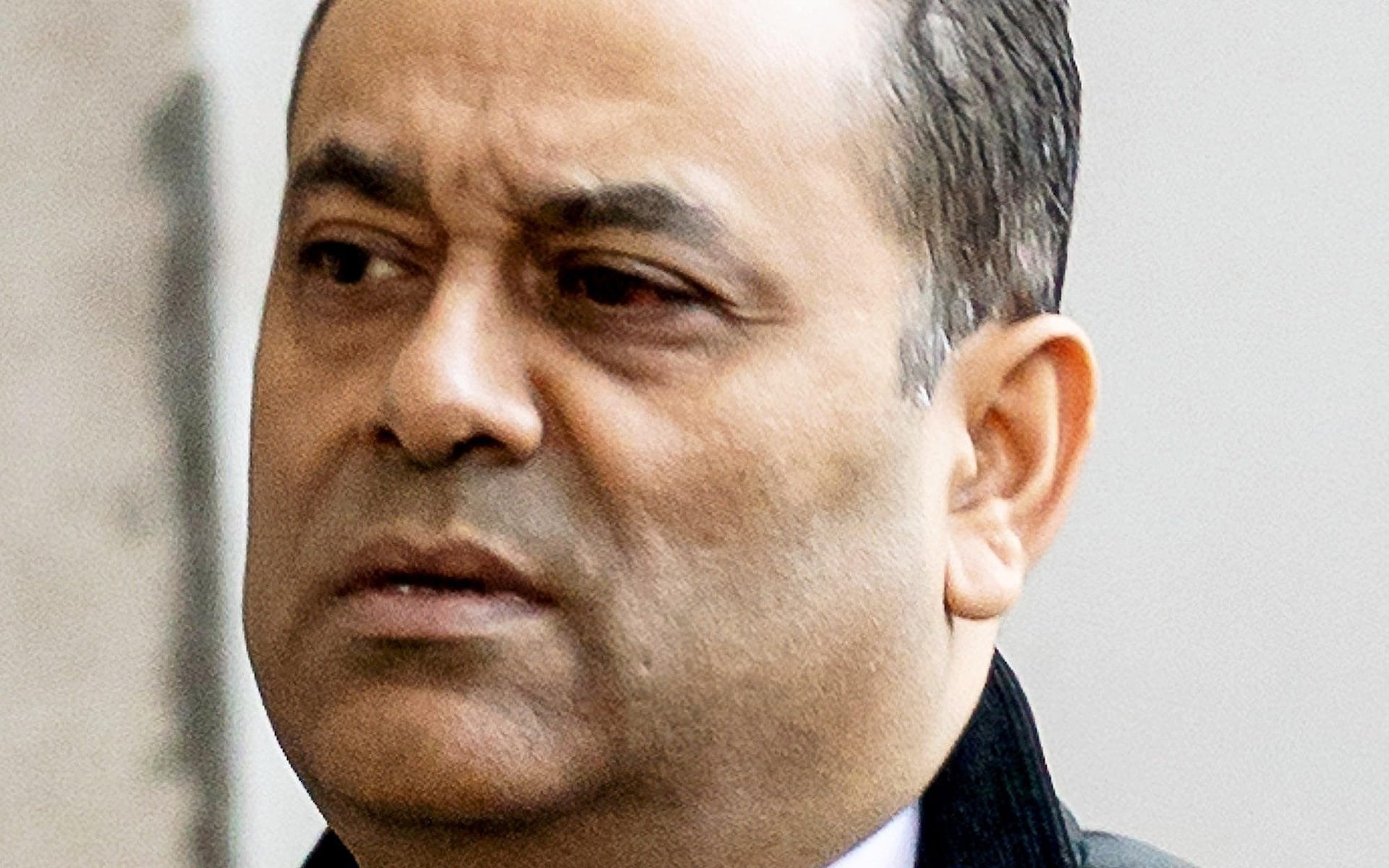 Tử vong sau khi nhổ 10 chiếc răng ảnh 1 Tu vong sau khi nho 10 chiec rang anh 1