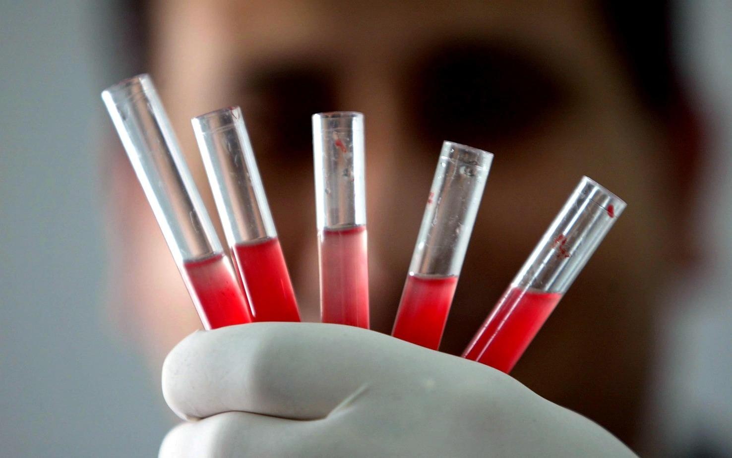 Nhom mau hiem nhat the gioi chi co 43 nguoi so huu hinh anh