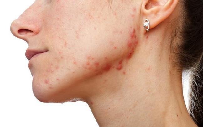 Dau hieu canh bao ban an qua nhieu duong hinh anh