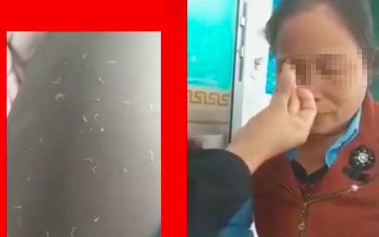 'Bat sau tren mat de tri viem xoang la tro lua bip' hinh anh