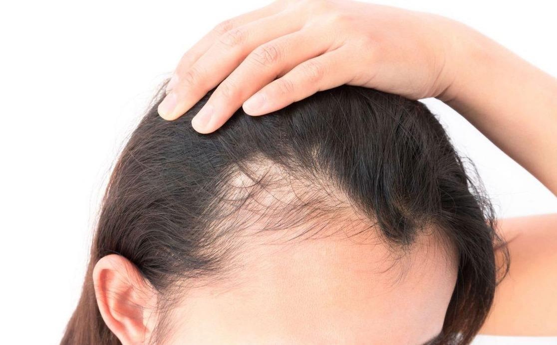 3 cong thuc kich thich moc toc tu hanh tay hinh anh