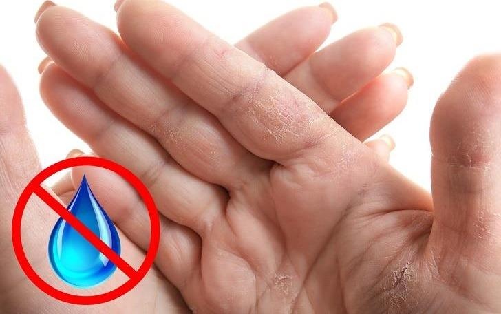 Bat thuong o ban tay tiet lo gi ve suc khoe? hinh anh