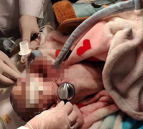 Bé sơ sinh bị mẹ bỏ rơi ảnh 1 Be so sinh bi me bo roi anh 1