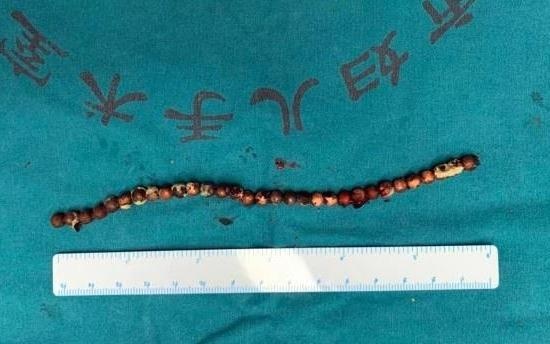 Cau be nhet 31 vien bi vao duong vat suot 70 ngay hinh anh