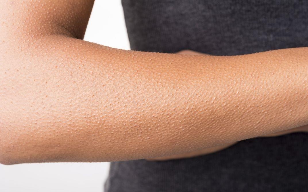 Giai ma hien tuong noi da ga hinh anh