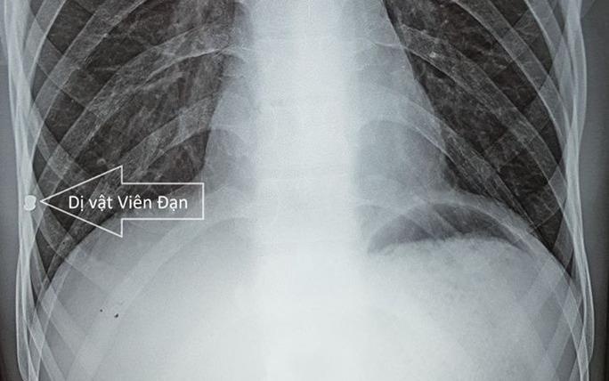 Nam thanh nien 20 nam 'song chung' voi dan hinh anh