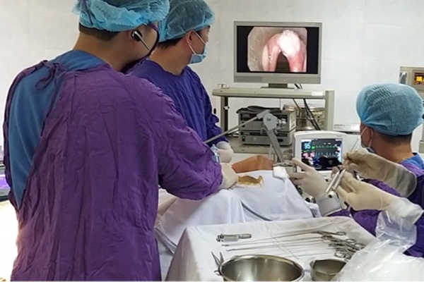 Ung thư thực quản vì hút thuốc ảnh 1 Ung thu thuc quan vi hut thuoc anh 1