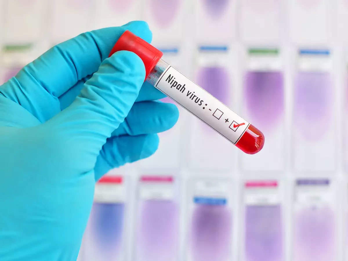 Virus gây chết người Nipah ảnh 1 Virus gay chet nguoi Nipah anh 1