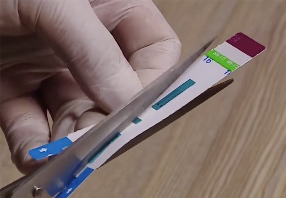 Don vi cung cap que thu HIV yeu cau BV Xanh Pon phai chiu trach nhiem hinh anh