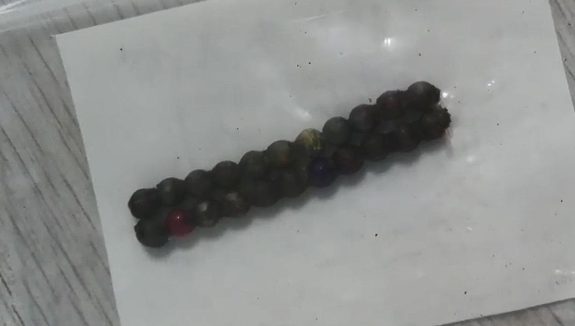 Be trai thung 6 lo thanh ruot vi nuot 22 hat nam cham hinh anh