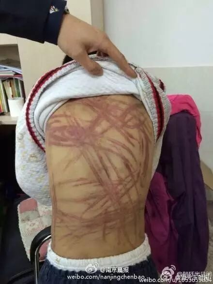 Mẹ ruột bạo hành con 7 tuổi ảnh 2 Me ruot bao hanh con 7 tuoi anh 2