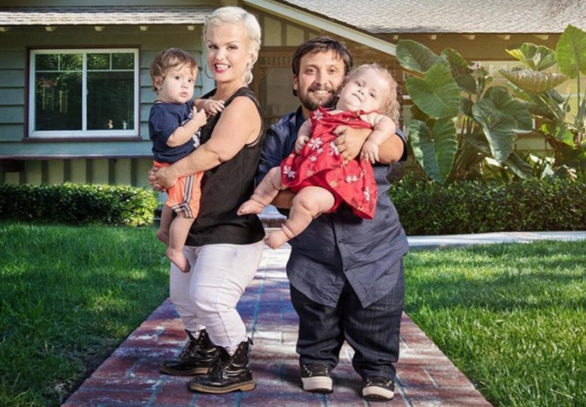 Nguyen nhan gay ra hoi chung nguoi lun hinh anh