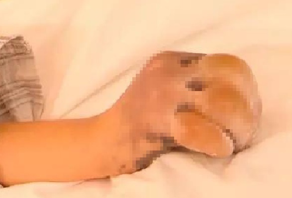 Be gai 13 tuoi co nguy co bi cat ngon tay vi don tuyet o truong hinh anh