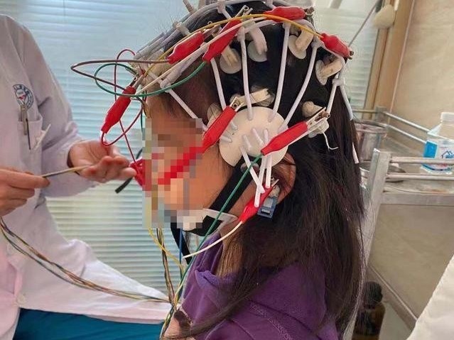 Be gai bi mu tam thoi vi bac si ke thuoc dong kinh tri cam lanh hinh anh