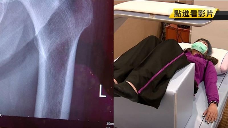 Gay xuong vi uong thuoc loi tieu anh 1