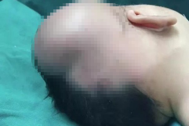 Be so sinh bi tu mau nao vi me de roi con xuong dat hinh anh