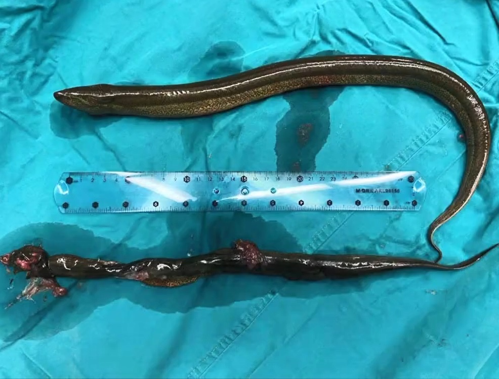 Suyt chet vi nuot 2 con luon song chua tao bon hinh anh