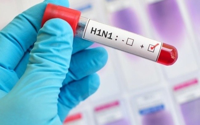 61 nguoi o Dai Loan tu vong vi cum H1N1 hinh anh