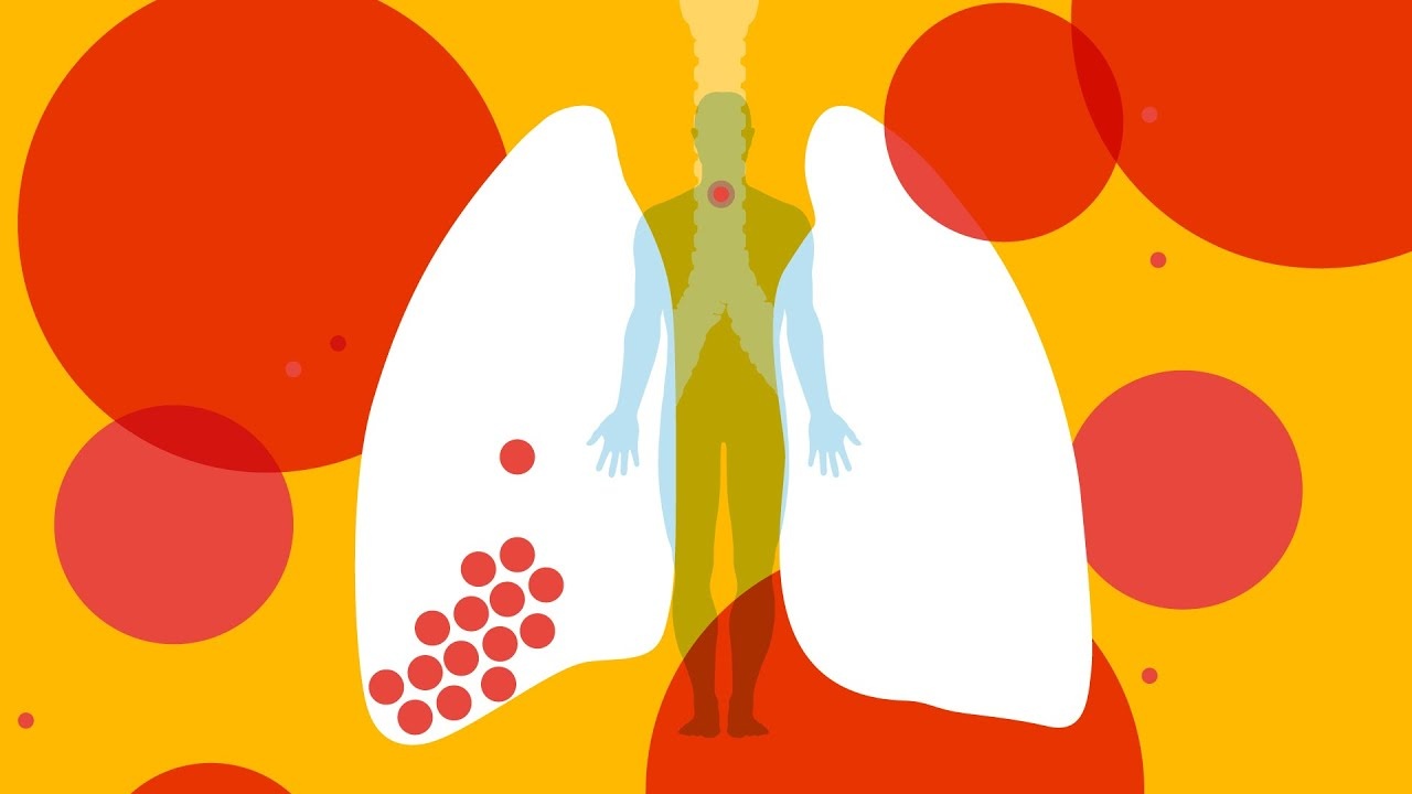 Co the phan ung nhu the nao khi nhiem virus corona? hinh anh