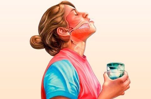 Suc mieng bang nuoc muoi co chua duoc viem hong? hinh anh