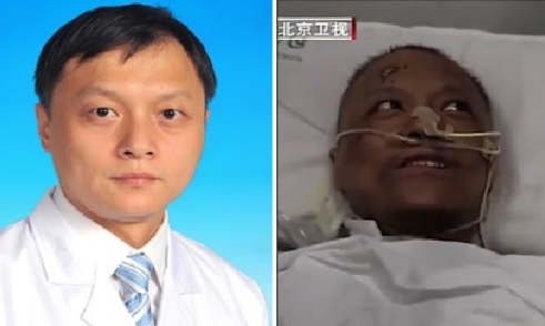 Vi sao lan da cua hai bac si mac Covid-19 doi mau? hinh anh