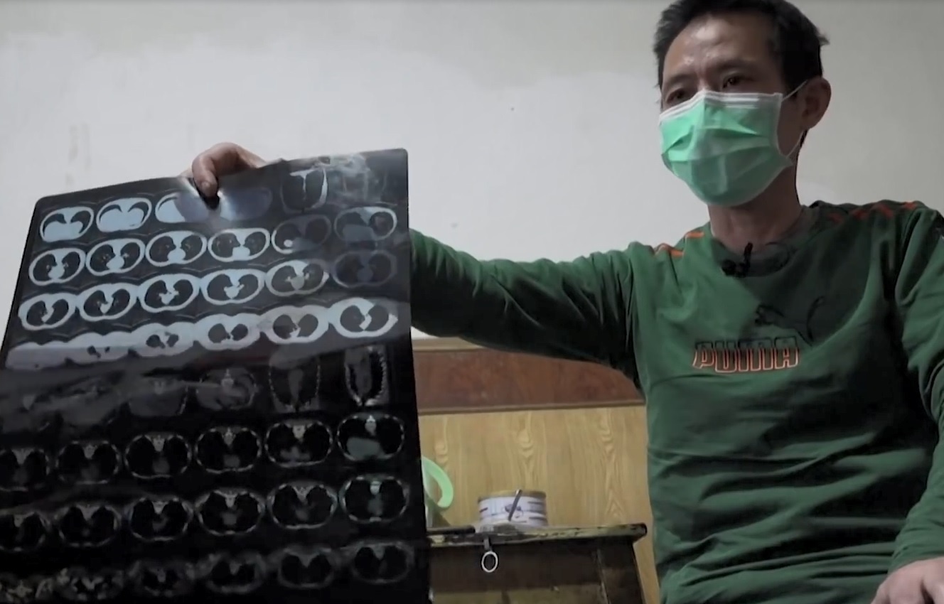 4 lan xet nghiem co ket qua am tinh gia truoc khi xac dinh mac Covid-19 hinh anh