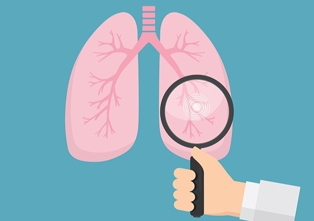 Con nguoi song nhu the nao neu thieu mot la phoi? hinh anh