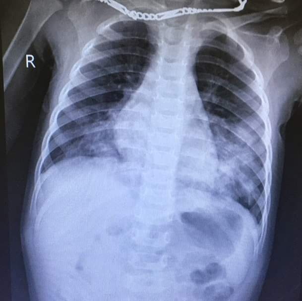 Tre uong nham hoa chat tay trang anh 1