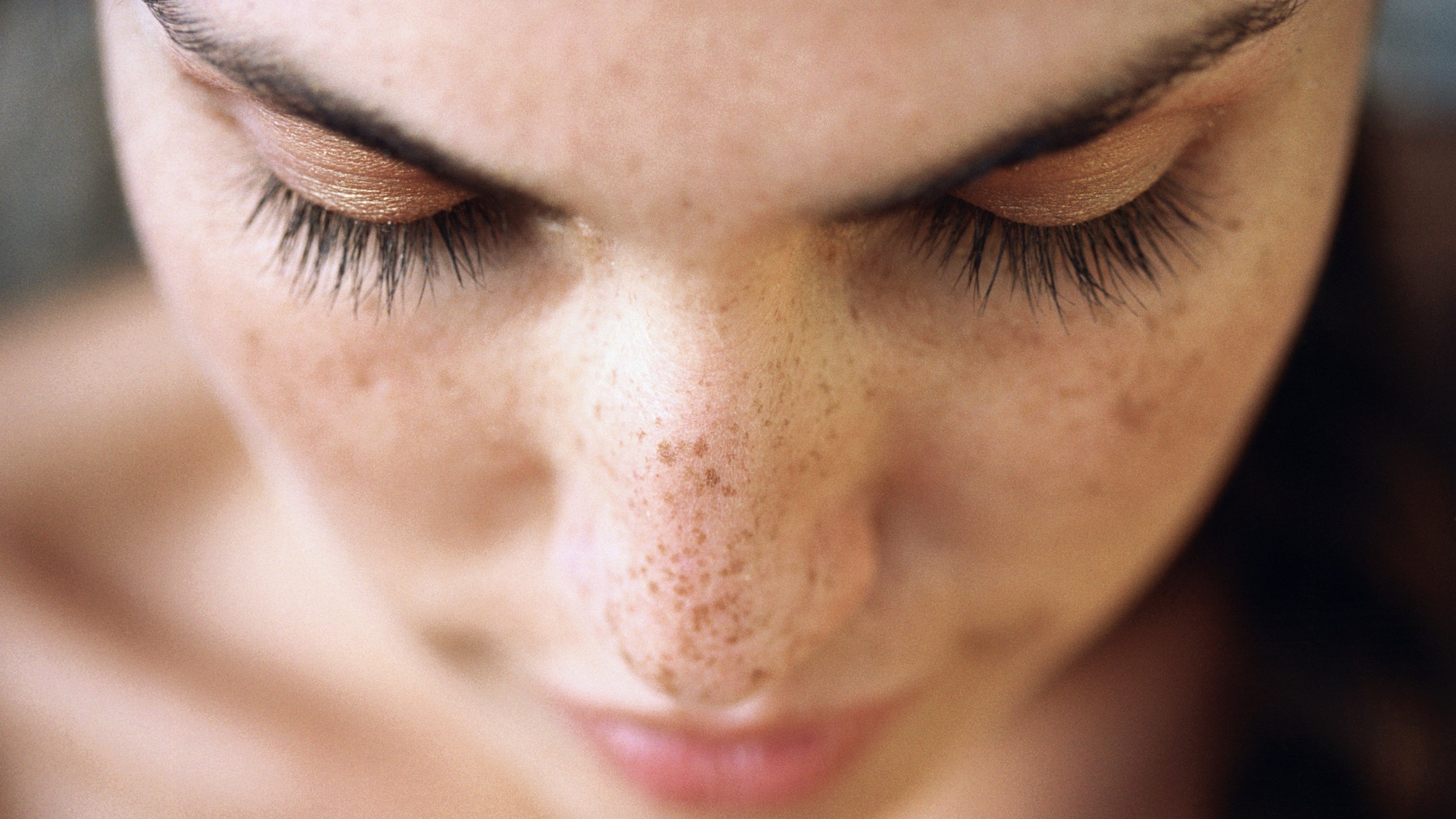 Tan nhang hinh thanh tren da nhu the nao? hinh anh