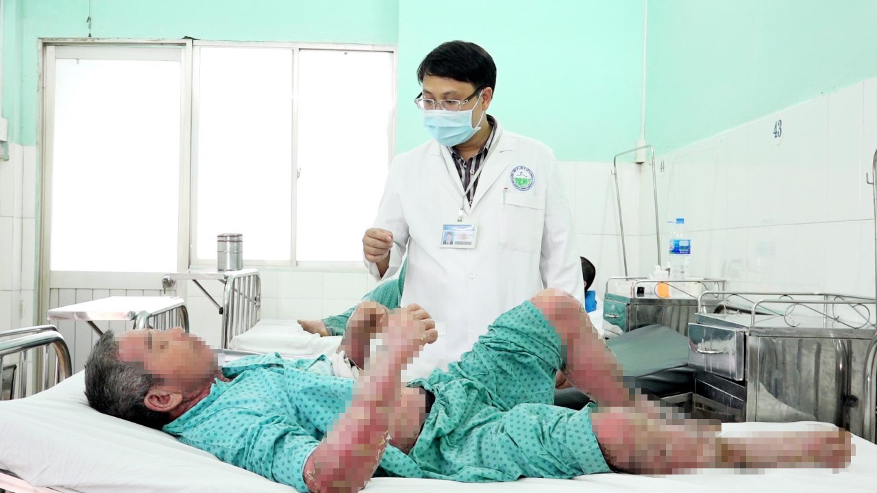 Tu mua thuoc tri vay nen tren mang anh 1