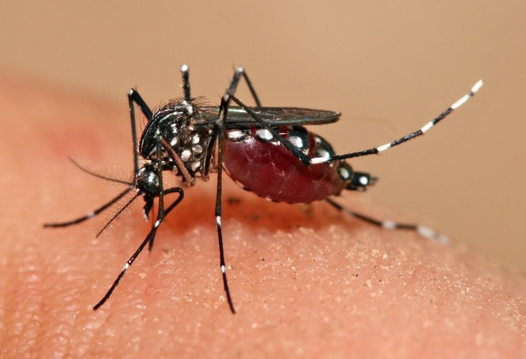 Biến chứng của virus Zika ảnh 1 Bien chung cua virus Zika anh 1