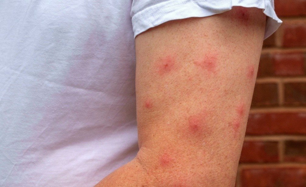 Tai sao muoi thich dot ban? hinh anh