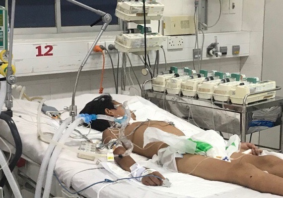 Be trai 13 tuoi mac bach hau o Dak Nong nguy kich hinh anh