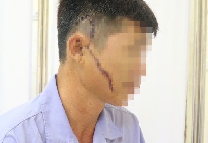 Nguoi dan ong bi khung ton sat nang 50 kg roi trung mat hinh anh