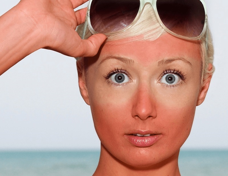 Tai sao ban lai bi chay nang? hinh anh