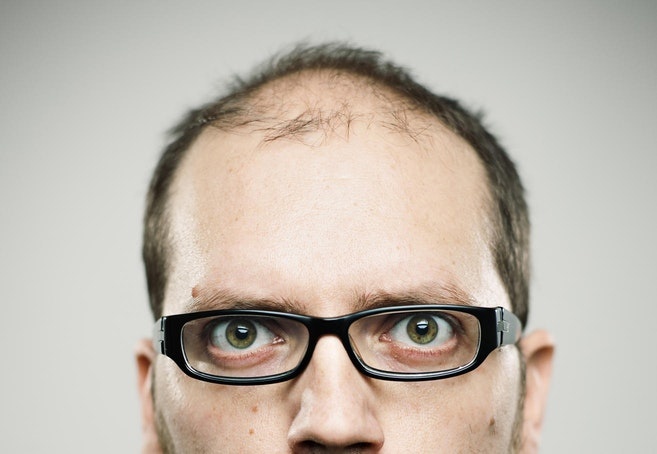 Tai sao ban lai bi hoi dau? hinh anh