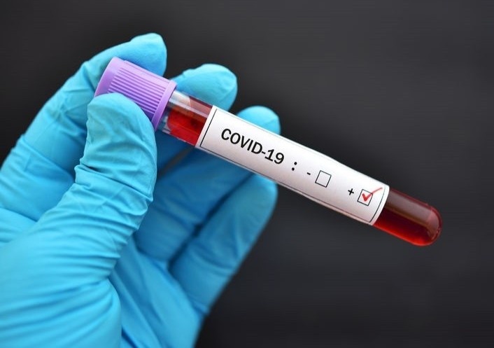 Nu sinh Singapore bi chan doan nham mac Covid-19 hinh anh