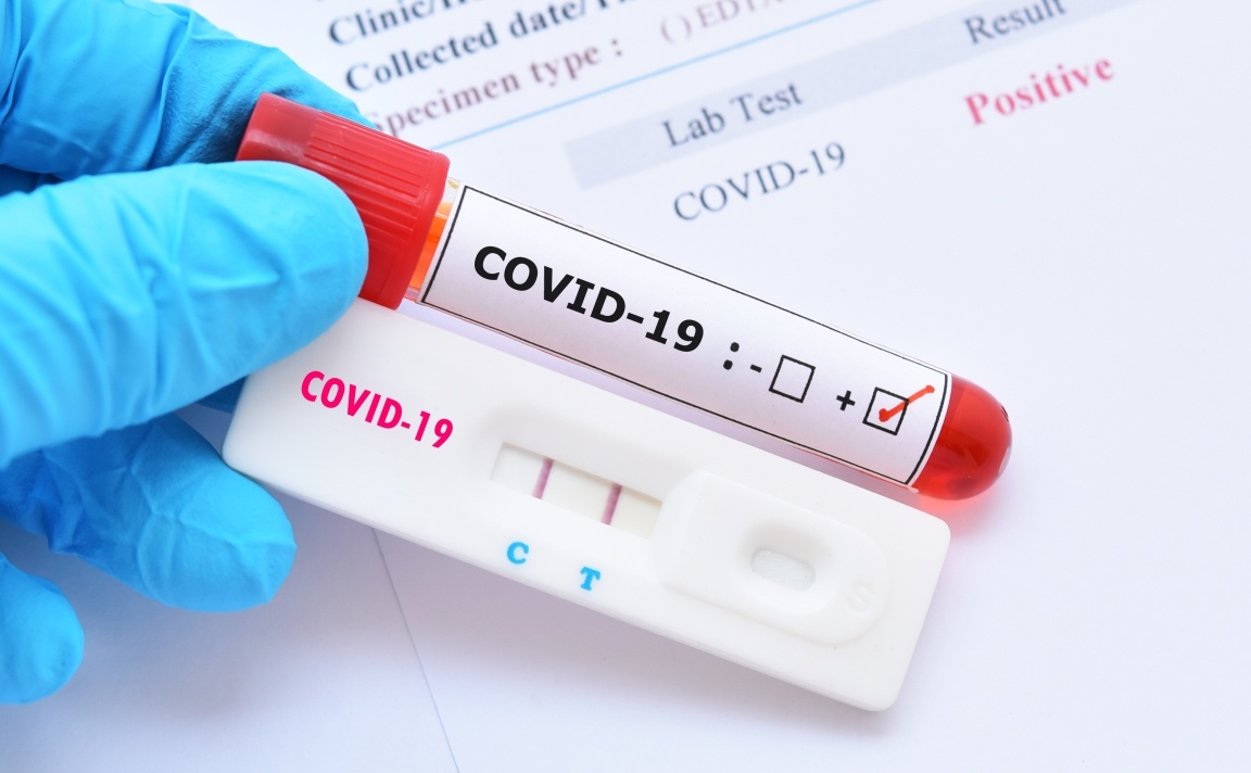 Singapore phat trien bo xet nghiem Covid-19 trong 2 gio hinh anh