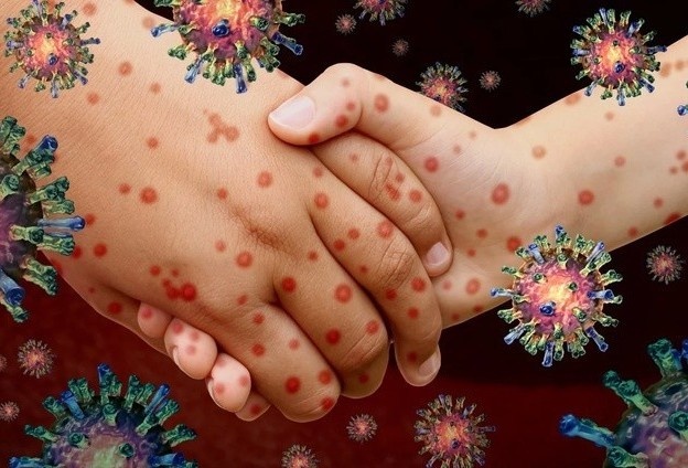 Viec can lam khi Covid-19 bung phat tro lai hinh anh