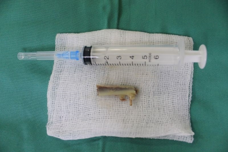 Xuong vit dai 3 cm chan ngang thuc quan hinh anh