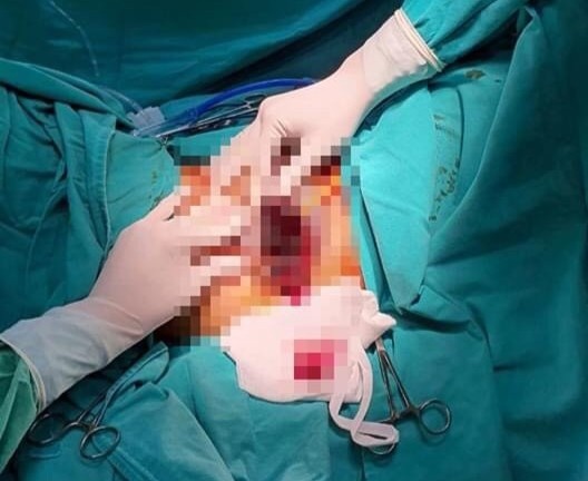 Tan trang vung kin o co so chui anh 1