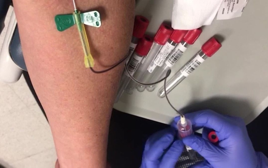 Quy trinh thu nghiem vaccine Covid-19 tren nguoi o My hinh anh