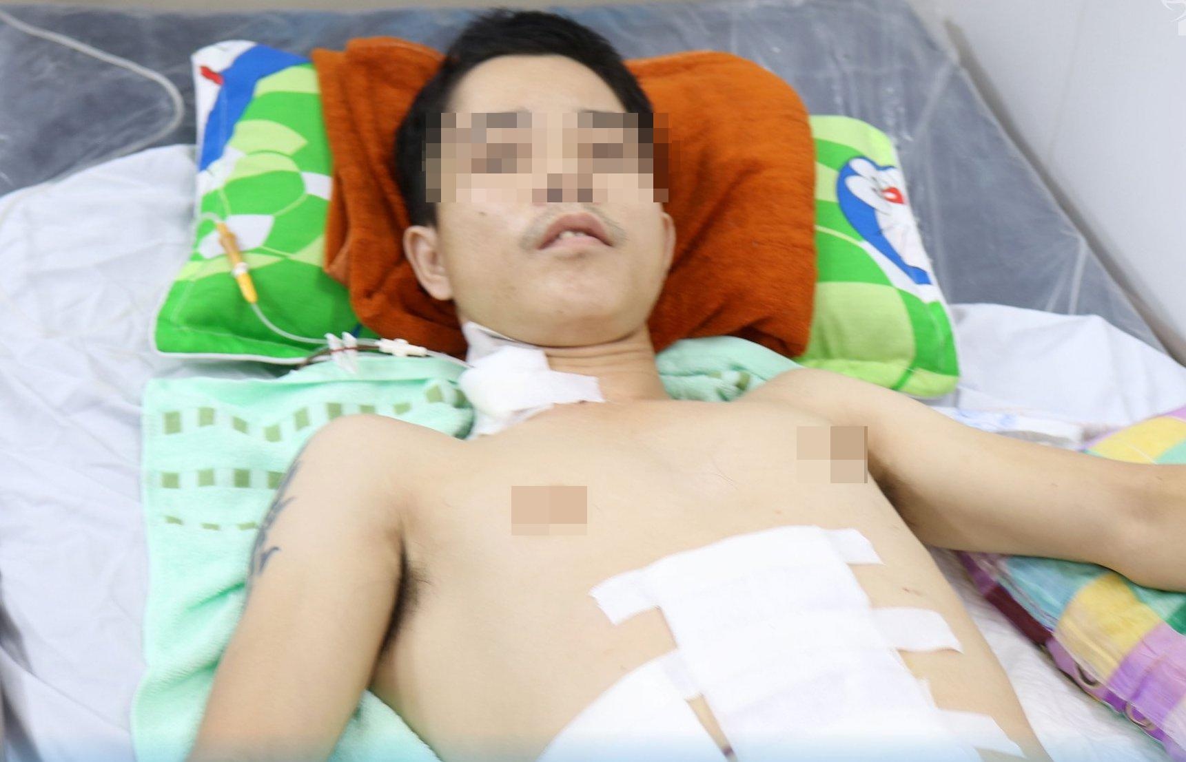 Benh nhan bi dam thung ruot anh 1