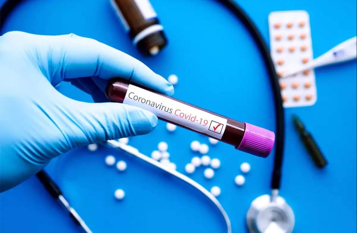 Hai nguoi tai nhiem SARS-CoV-2 o chau Au hinh anh