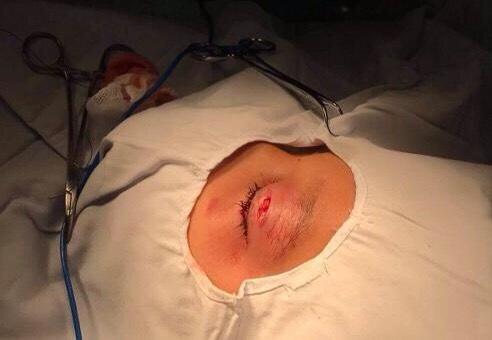 Ca mổ cứu mắt cho bé trai ảnh 1 Ca mo cuu mat cho be trai anh 1