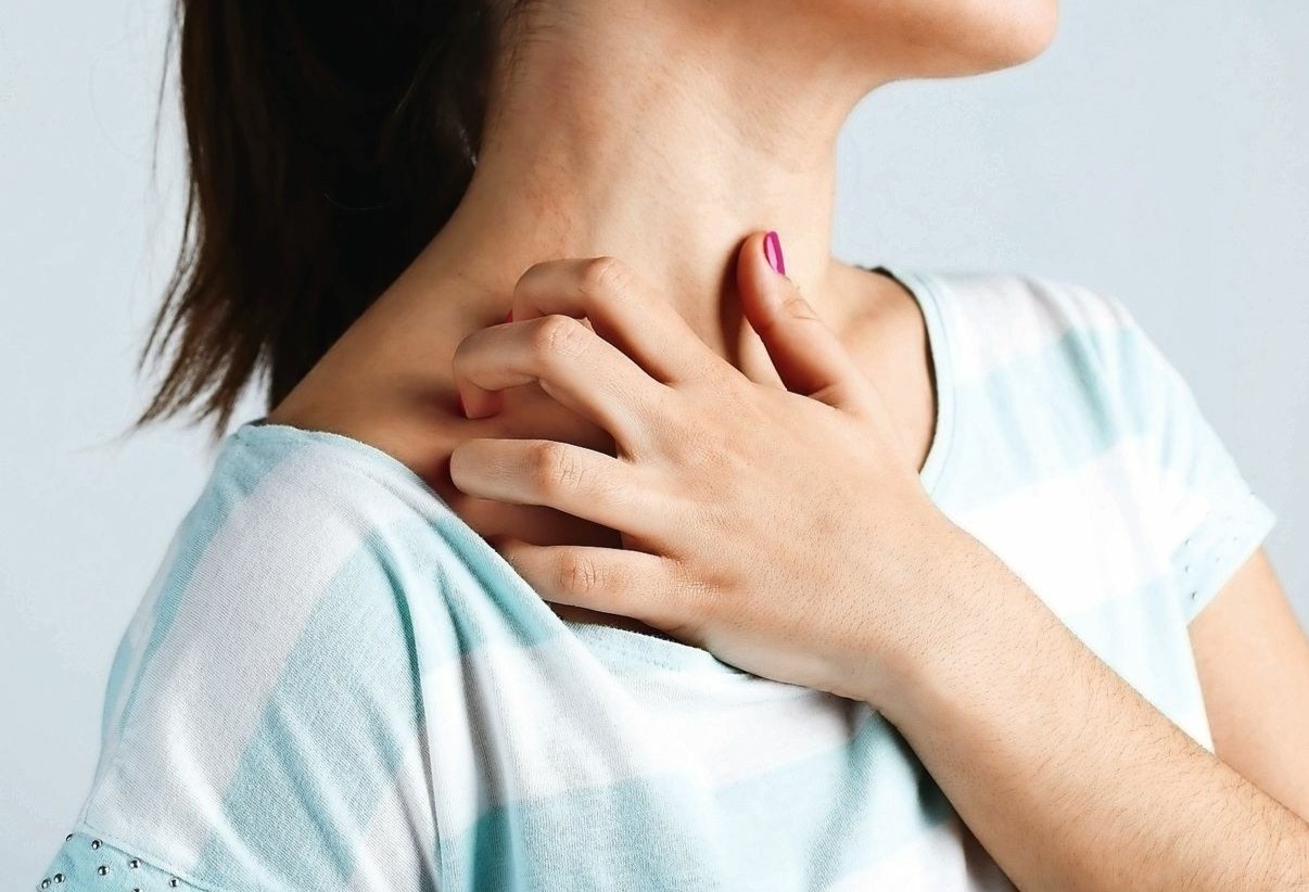 Trieu chung cua benh viem da di ung hinh anh