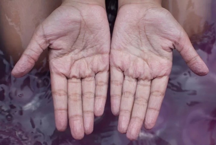 Ly do ngon tay bi nhan khi ngam nuoc hinh anh