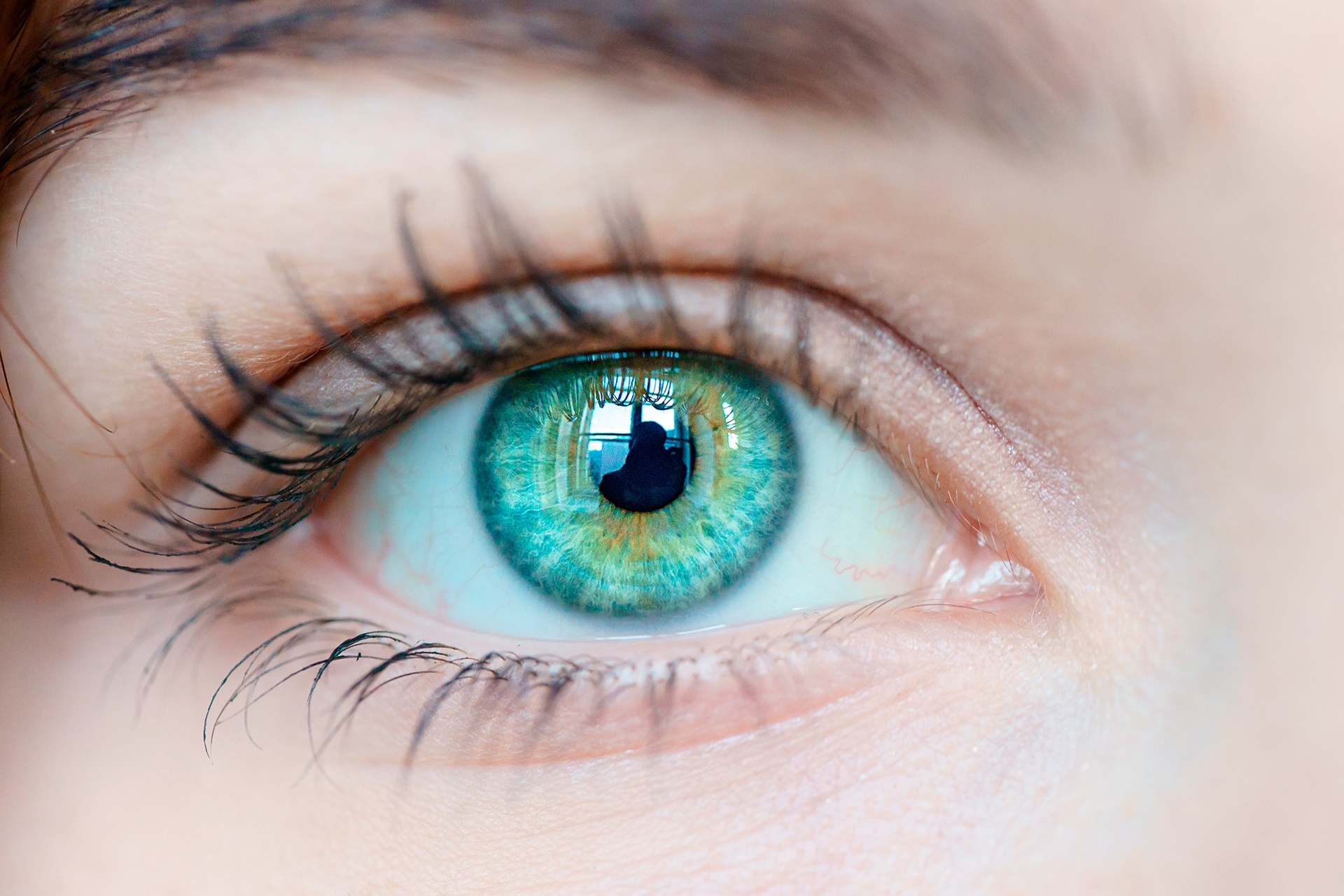 Nguyen nhan gay duc thuy tinh the hinh anh