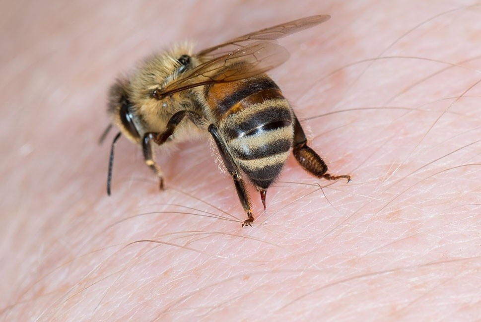 Cach dieu tri vet ong dot hinh anh