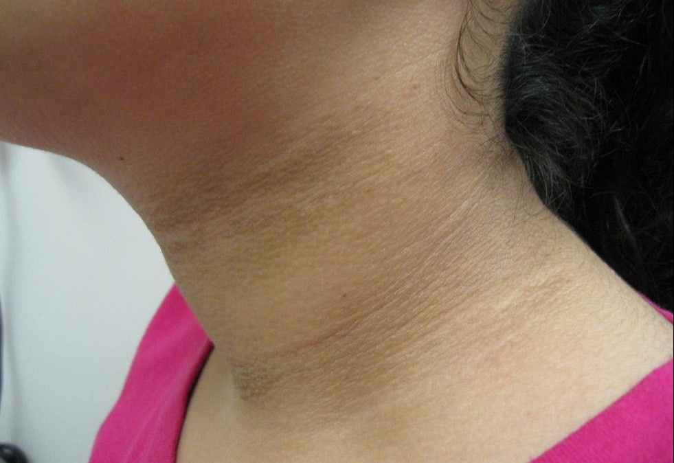 Dau hieu bat thuong tren da canh bao benh nguy hiem hinh anh